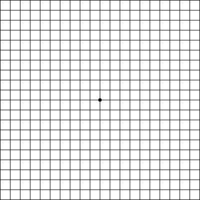 Macular Degeneration